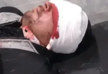 Dos cuñados resultaron gravemente heridos tras una violenta pelea con machetes en San Miguel, Corrientes