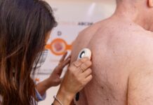 CORRIENTES: LLEGA UN CAMIÓN CON TRES CONSULTORIOS PARA CONTROLAR LUNARES GRATIS